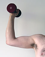 Arm